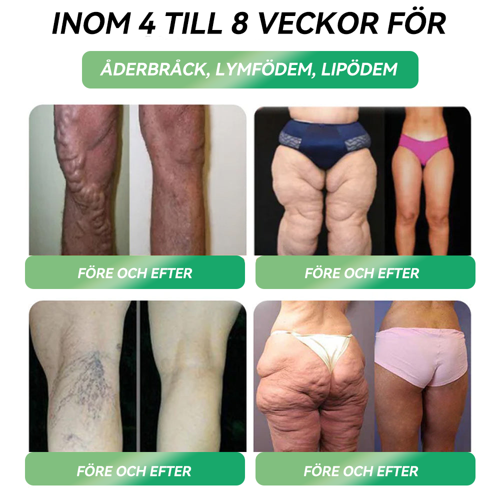 Total hälsa börjar här 🇸🇪 𝐒𝐓𝐃𝐄𝐈® 𝐆𝐋𝐏-𝟏 Ampull-droppar för viktminskning och häls förbättring 💪