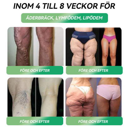 Total hälsa börjar här 🇸🇪 𝐒𝐓𝐃𝐄𝐈® 𝐆𝐋𝐏-𝟏 Ampull-droppar för viktminskning och häls förbättring🧨